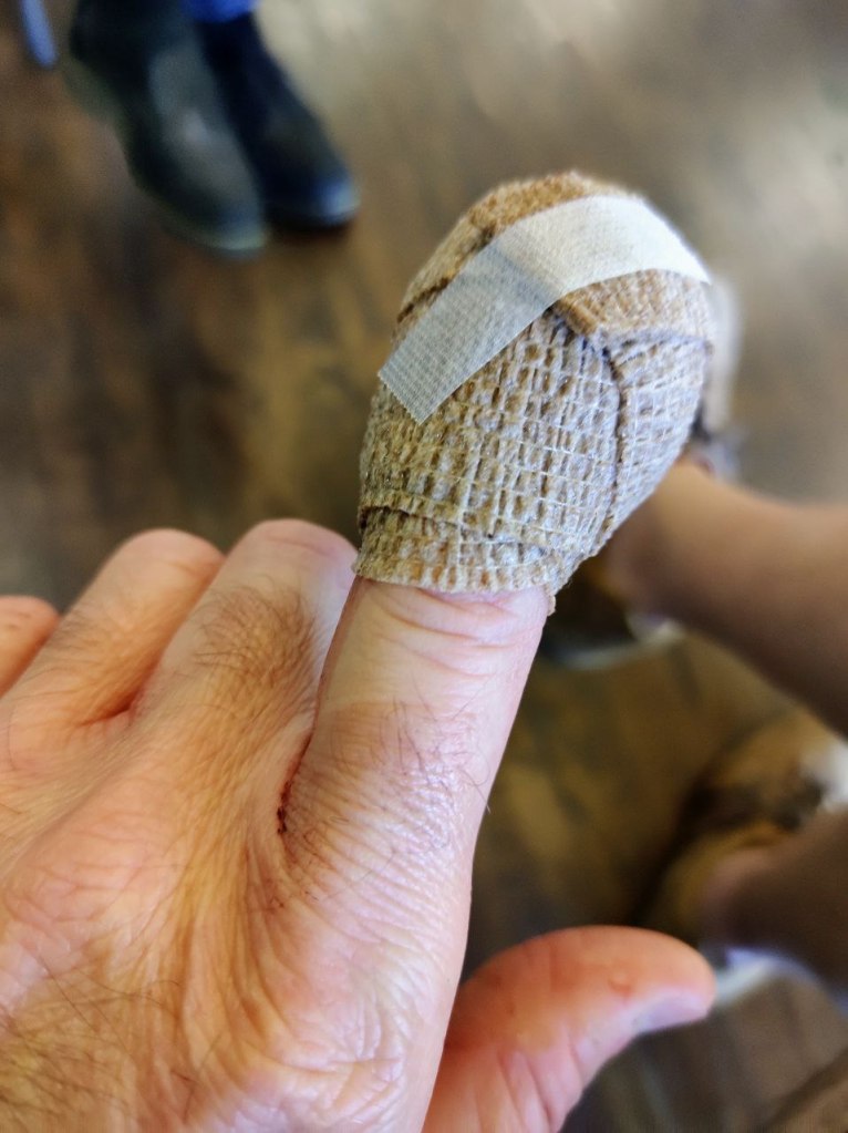 finger all bandaged up